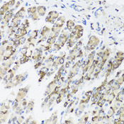 TIMM10B / FXC1 Antibody - Immunohistochemistry of paraffin-embedded mouse stomach tissue.