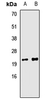TIMM10B / FXC1 Antibody