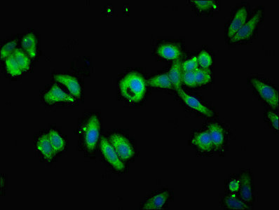 TIMM10B / FXC1 Antibody - Immunofluorescent analysis of HepG2 cells diluted at 1:100 and Alexa Fluor 488-congugated AffiniPure Goat Anti-Rabbit IgG(H+L)