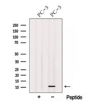 TIMM13 Antibody - Western blot analysis of extracts of PC-3 cells using TIMM13 antibody. The lane on the left was treated with blocking peptide.