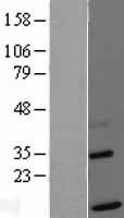 TIMM13 Protein - Western validation with an anti-DDK antibody * L: Control HEK293 lysate R: Over-expression lysate