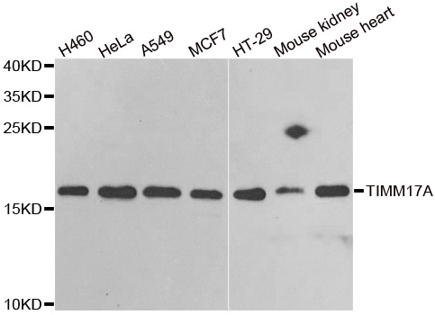 TIMM17A / TIM17 Antibody - Western blot analysis of extracts of various cell lines.