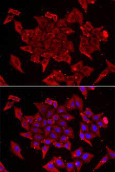 TIMM17A / TIM17 Antibody - Immunofluorescence analysis of U2OS cells.