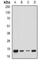 TIMM17A / TIM17 Antibody - Western blot analysis of Tim17 expression in A549 (A); MCF7 (B); mouse kidney (C); mouse heart (D) whole cell lysates.