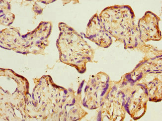 TIMM17A / TIM17 Antibody - Immunohistochemistry of paraffin-embedded human placenta tissue at dilution 1:100