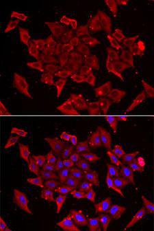 TIMM17A / TIM17 Antibody - Immunofluorescence analysis of U2OS cells using TIMM17A antibody. Blue: DAPI for nuclear staining.