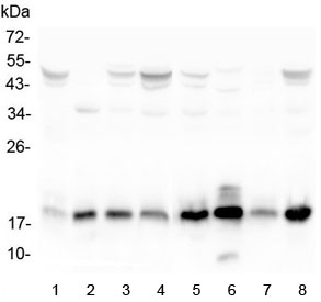 TIMM17A / TIM17 Antibody - Western blot testing of human 1) placenta, 2) K562, 3) T-47D, 4) Caco-2, 5) HeLa, 6) ThP-1, 7) A431 and 8) A549 lysate with TIMM17A antibody at 0.5ug/ml. Predicted molecular weight ~18 kDa.