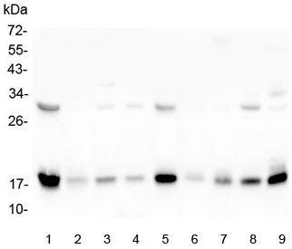 TIMM17A / TIM17 Antibody - Western blot testing of 1) rat heart, 2) rat lung, 3) rat liver, 4) rat brain, 5) mouse heart, 6) mouse lung, 7) mouse liver, 8) mouse brain and 9) mouse Neuro-2a lysate with TIMM17A antibody at 0.5ug/ml. Predicted molecular weight ~18 kDa.