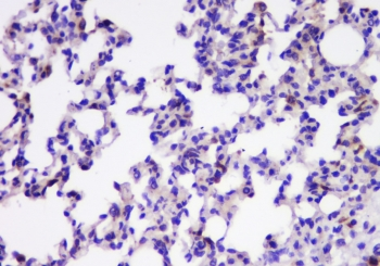 TIMM17A / TIM17 Antibody - IHC staining of FFPE rat lung with TIMM17A antibody at 1ug/ml. HIER: boil tissue sections in pH6, 10mM citrate buffer, for 10-20 min and allow to cool before testing.