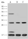 TIMM17A / TIM17 Antibody - Anti-TIMM17A rabbit polyclonal antibody at 1:500 dilution. Lane A: HeLa Whole Cell Lysate. Lane B: K562 Whole Cell Lysate. Lane C: U-251 MG Whole Cell Lysate. Lysates/proteins at 30 ug per lane. Secondary: Goat Anti-Rabbit IgG (H+L)/HRP at 1/10000 dilution. Developed using the ECL technique. Performed under reducing conditions. Predicted band size: 18 kDa. Observed band size: 18 kDa.