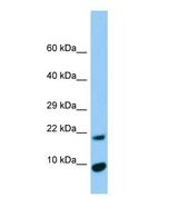 TIMM17A / TIM17 Antibody - Western blot of Timm17a Antibody - N-terminal region in Rat Pancreas cells lysate.  This image was taken for the unconjugated form of this product. Other forms have not been tested.