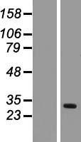 TIMM17A / TIM17 Protein - Western validation with an anti-DDK antibody * L: Control HEK293 lysate R: Over-expression lysate