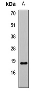 TIMM17B Antibody