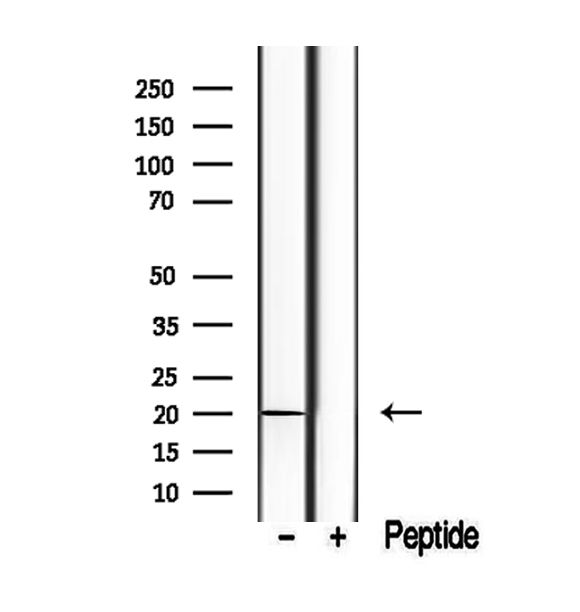 TIMM17B Antibody - Western blot analysis of extracts of mouse liver tissue using TIMM17B antibody.