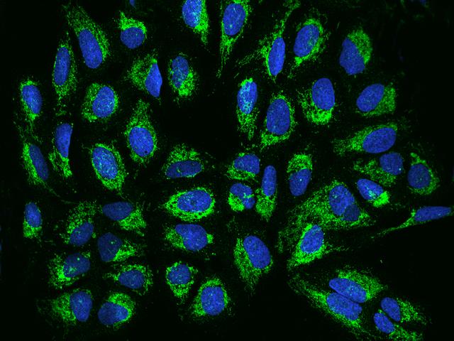 TIMM17B Antibody - Immunofluorescence staining of TIMM17B in U2OS cells. Cells were fixed with 4% PFA, permeabilzed with 0.1% Triton X-100 in PBS, blocked with 10% serum, and incubated with rabbit anti-Human TIMM17B polyclonal antibody (dilution ratio 1:200) at 4°C overnight. Then cells were stained with the Alexa Fluor 488-conjugated Goat Anti-rabbit IgG secondary antibody (green) and counterstained with DAPI (blue). Positive staining was localized to Cytoplasm.