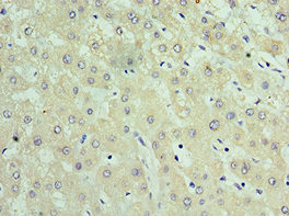 TIMM21 Antibody - Immunohistochemistry of paraffin-embedded human liver tissue using TIMM21 Antibody at dilution of 1:100