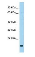 TIMM23B Antibody - TIMM23B antibody Western Blot of Fetal Brain.  This image was taken for the unconjugated form of this product. Other forms have not been tested.