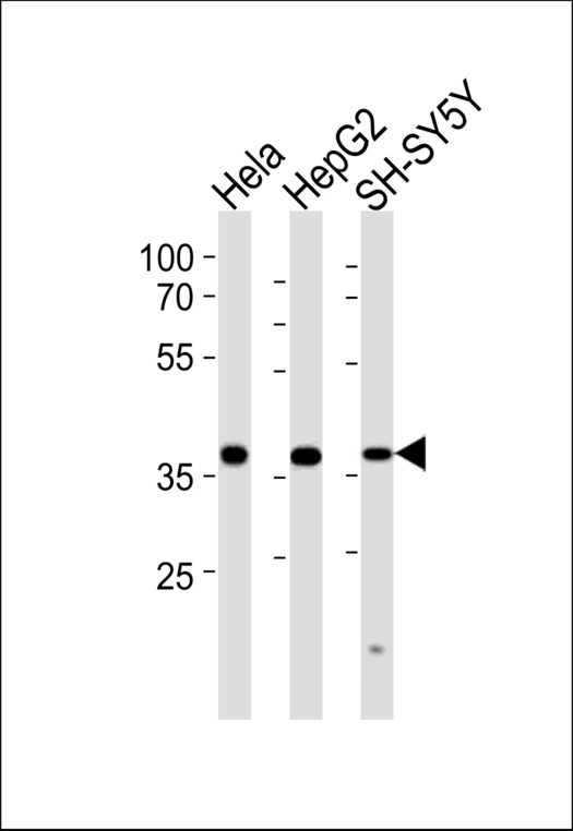 TIMM50 Antibody - Western blot of lysates from HeLa, HepG2, SH-SY5Y cell line (from left to right) with TIMM50 Antibody. Antibody was diluted at 1:1000 at each lane. A goat anti-rabbit IgG H&L (HRP) at 1:5000 dilution was used as the secondary antibody. Lysates at 35 ug per lane.