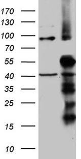 TIMM50 Antibody - HEK293T cells were transfected with the pCMV6-ENTRY control. (Left lane) or pCMV6-ENTRY TIMM50. (Right lane) cDNA for 48 hrs and lysed. Equivalent amounts of cell lysates. (5 ug per lane) were separated by SDS-PAGE and immunoblotted with anti-TIMM50. (1:2000)