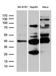 TIMM50 Antibody - Western blot analysis of extracts. (35ug) from 3 different cell lines by using anti-TIMM50 monoclonal antibody. (1:500)