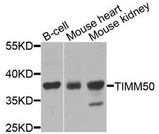 TIMM50 Antibody - Western blot analysis of extracts of various cells.