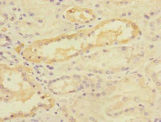 TIMM50 Antibody - Immunohistochemistry of paraffin-embedded human kidney tissue at dilution 1:100