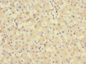 TIMM50 Antibody - Immunohistochemistry of paraffin-embedded human liver tissue at dilution 1:100