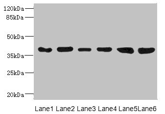 TIMM50 Antibody - Western blot All Lanes: TIMM50 antibody at 4.05ug/ml Lane 1: Ret heart tissue Lane 2: Human breast cancer cell lines Lane 3: MCF7 whole cell lysate Lane 4: Hela whole cell lysate Lane 5: 293T whole cell lysate Lane 6: HepG-2 whole cell lysate Secondary Goat polyclonal to rabbit IgG at 1/10000 dilution Predicted band size: 40,51,28 kDa Observed band size: 40 kDa