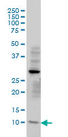 TIMM8A Antibody - TIMM8A monoclonal antibody (M01), clone 2F11 Western blot of TIMM8A expression in HeLa.