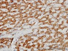 TIMM8A Antibody - Immunoperoxidase of monoclonal antibody to TIMM8A on formalin-fixed paraffin-embedded human liver. [antibody concentration 3 ug/ml].