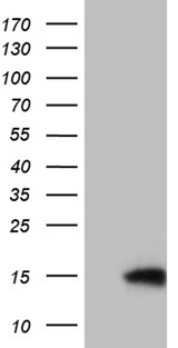 TIMM8A Antibody - HEK293T cells were transfected with the pCMV6-ENTRY control. (Left lane) or pCMV6-ENTRY TIMM8A. (Right lane) cDNA for 48 hrs and lysed. Equivalent amounts of cell lysates. (5 ug per lane) were separated by SDS-PAGE and immunoblotted with anti-TIMM8A. (1:2000)