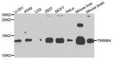 TIMM8A Antibody - Western blot analysis of extracts of various cells.