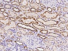 TIMM8A Antibody - Immunochemical staining of human TIMM8A in human kidney with rabbit polyclonal antibody at 1:100 dilution, formalin-fixed paraffin embedded sections.