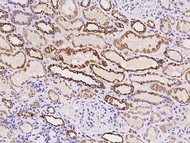 TIMM8A Antibody - Immunochemical staining of human TIMM8A in human kidney with rabbit polyclonal antibody at 1:100 dilution, formalin-fixed paraffin embedded sections.