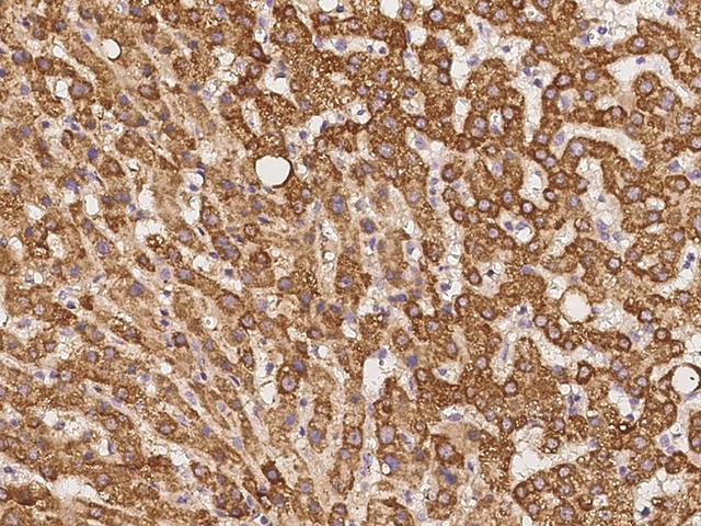 TIMM8A Antibody - Immunochemical staining of human TIMM8A in human liver with rabbit polyclonal antibody at 1:100 dilution, formalin-fixed paraffin embedded sections.