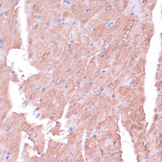 TIMM8B Antibody - Immunohistochemistry of paraffin-embedded Mouse heart using TIMM8B Polyclonal Antibody at dilution of 1:100 (40x lens).