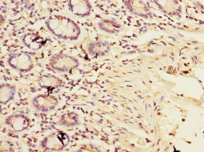 TIMM9 Antibody - Immunohistochemistry of paraffin-embedded human small intestine tissue using antibody at dilution of 1:100.