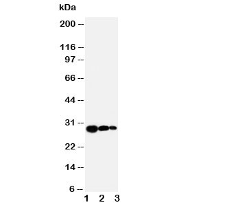 TIMP1 Antibody - Western blot testing of TIMP1 antibody and Lane 1: recombinant human protein 10ng; 2: 5ng; 3. 2.5ng