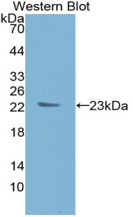 TIMP1 Antibody - Western blot of recombinant TIMP1.