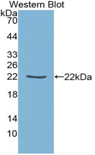 TIMP1 Antibody - Western blot of recombinant TIMP1.