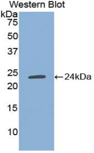 TIMP1 Antibody - Western blot of recombinant TIMP1.  This image was taken for the unconjugated form of this product. Other forms have not been tested.