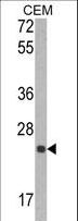 TIMP1 Antibody - Western blot of TIMP1 Antibody in CEM cell line lysates (35 ug/lane). TIMP1 (arrow) was detected using the purified antibody.