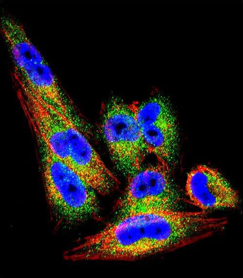 TIMP1 Antibody - Confocal immunofluorescence of TIMP1 Antibody with A2058 cell followed by Alexa Fluor 488-conjugated goat anti-rabbit lgG (green). Actin filaments have been labeled with Alexa Fluor 555 phalloidin (red). DAPI was used to stain the cell nuclear (blue).