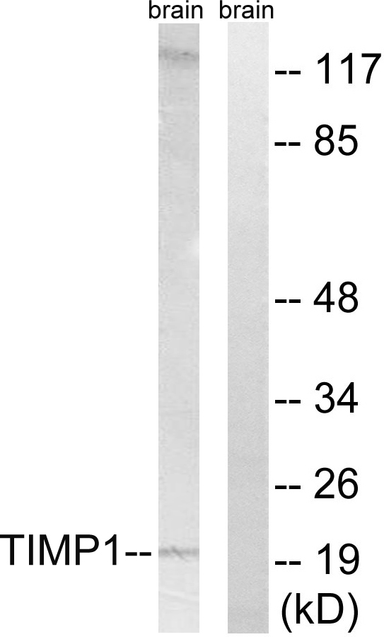 TIMP1 Antibody - Western blot analysis of lysates from rat brain cells, using TIMP1 Antibody. The lane on the right is blocked with the synthesized peptide.