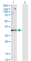 TIMP1 Antibody - Western Blot analysis of TIMP1 expression in transfected 293T cell line by TIMP1 monoclonal antibody (M01), clone 4D12.Lane 1: TIMP1 transfected lysate(23.2 KDa).Lane 2: Non-transfected lysate.