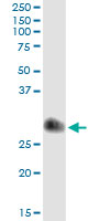 TIMP1 Antibody - Immunoprecipitation of TIMP1 transfected lysate using anti-TIMP1 monoclonal antibody and Protein A Magnetic Bead, and immunoblotted with TIMP1 rabbit polyclonal antibody.