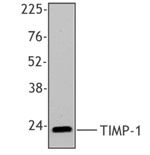 TIMP1 Antibody - Western blot of recombinant human TIMP-1 protein using anti-TIMP-1, clone F31P2A5.