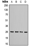 TIMP1 Antibody - Western blot analysis of TIMP1 expression in SHSY5Y (A); HEK293T (B); mouse kidney (C); H9C2 (D) whole cell lysates.
