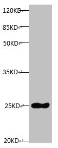 TIMP1 Antibody - All lanes: Mouse anti-Human Timp1 monoclonal antibody at 1ug/ml Lane 1: TIMP1 transfected pichia Yeast cell lysate Predicted band size : 23 kDa Observed band size:23 kDa