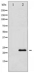 TIMP1 Antibody - Western blot of TIMP1 expression in 293 whole cell lysates,The lane on the left is treated with the antigen-specific peptide.